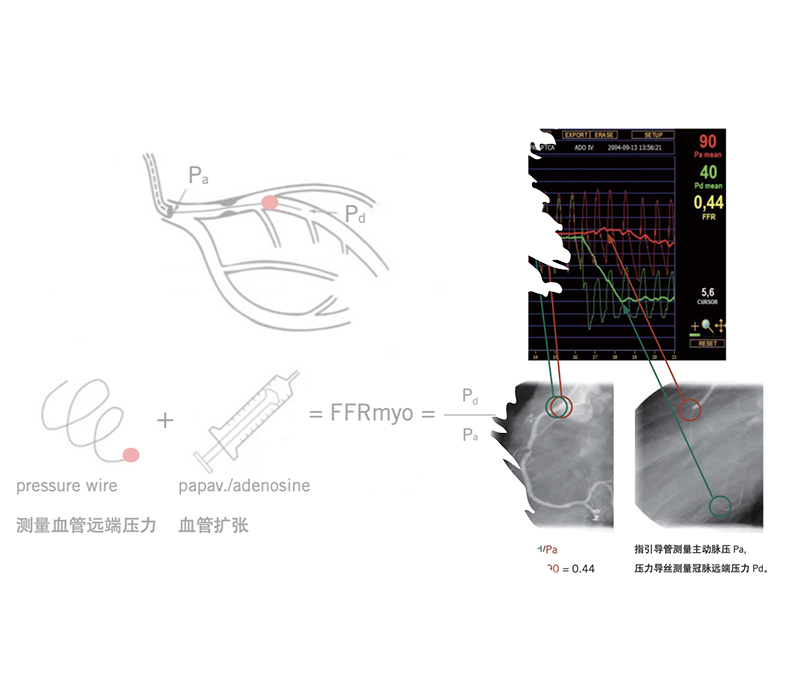 Pfa Rfa 成功案例_孚感光电科技